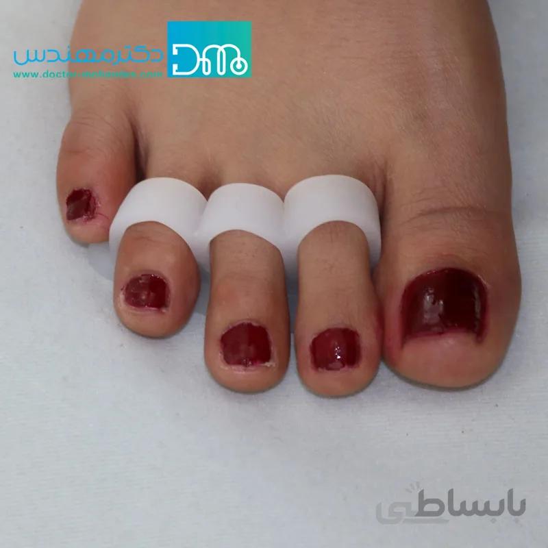 جداکننده ژله ای سه حلقه ای(انگشت چکشی) سما طب کد6057