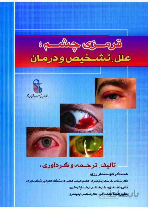 قرمزی چشم (علل، تشخیص و درمان)
