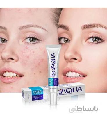کرم ضدجوش بیوآکوا
