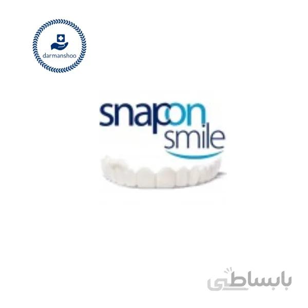 لمینت دندان اسنپ آن اسمایل بالا و پایین