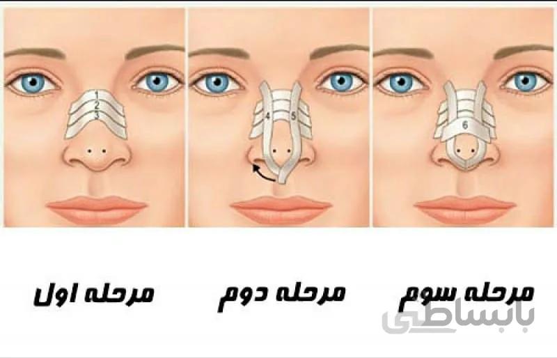 چسب لیفت بینی کد 642646
