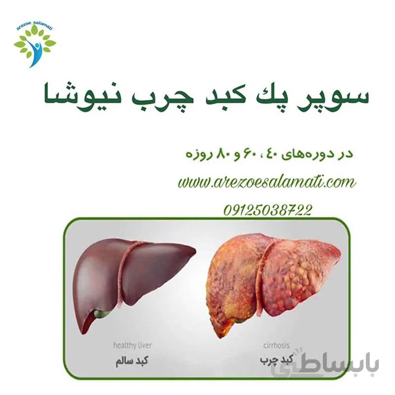 سوپر پک کبدچرب نیوشا