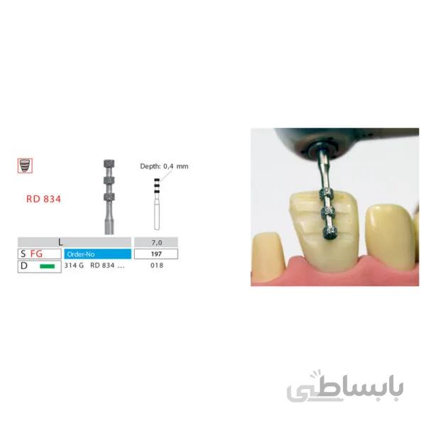 فرز خاص