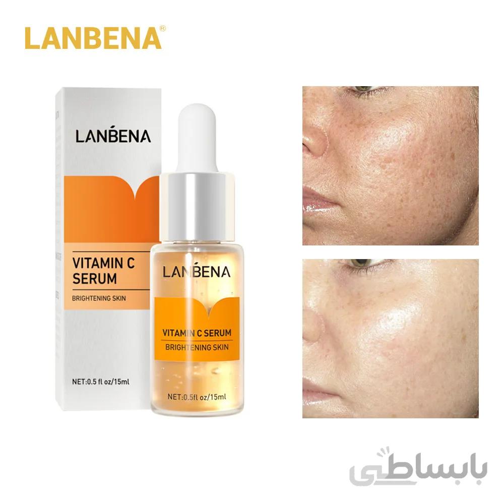 سرم هیالورونیک اسید ابرسان لانبنا ا soromelanbene0028