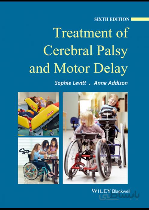 Treatment of Cerebral Palsy and Motor Delay