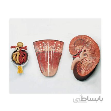 مولاژ کلیه سه قسمتی
