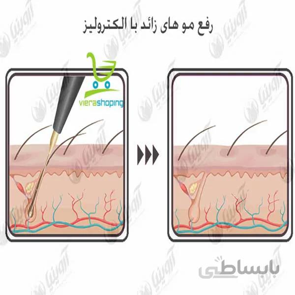 دستگاه الکترولیز اتومات star max beauty auto