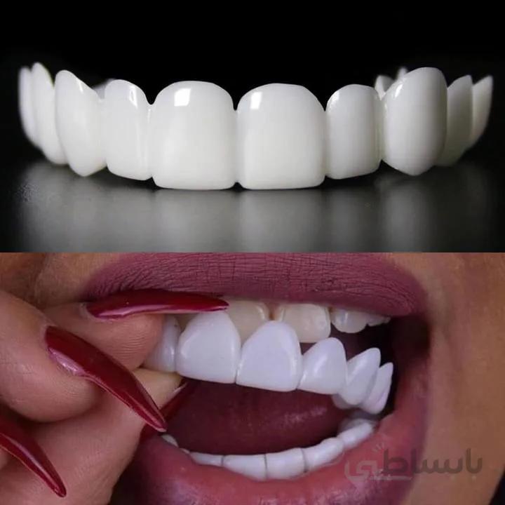 لمینت متحرک دندان اسنپ اسمایل دو فک
