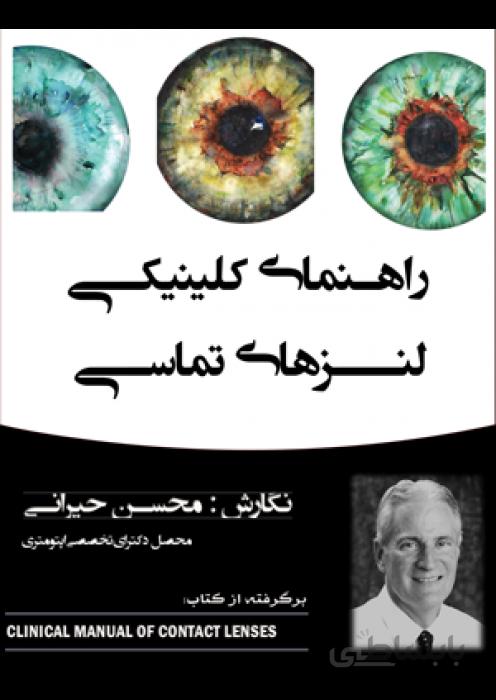راهنمای کلینیکی لنزهای تماسی