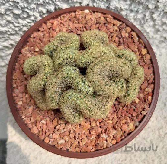 مامیلاریا مغزی بسیار خاص