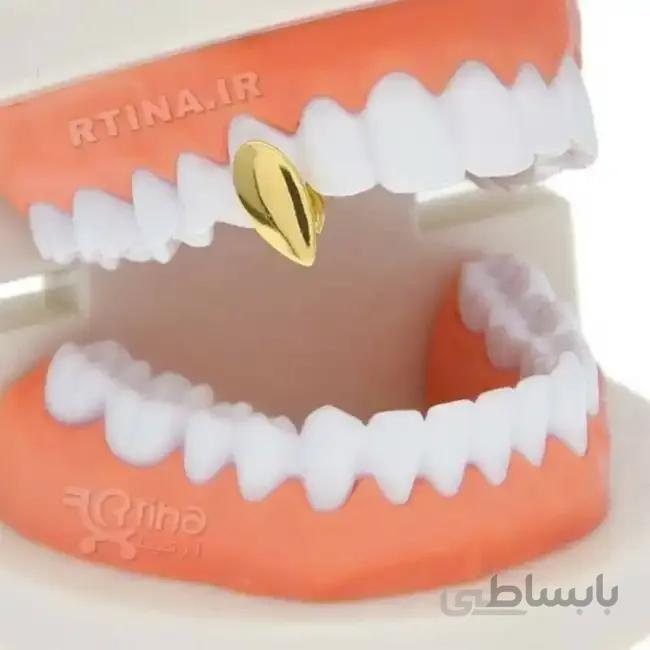 روکش تزئینی تک دندان مدل Vampire