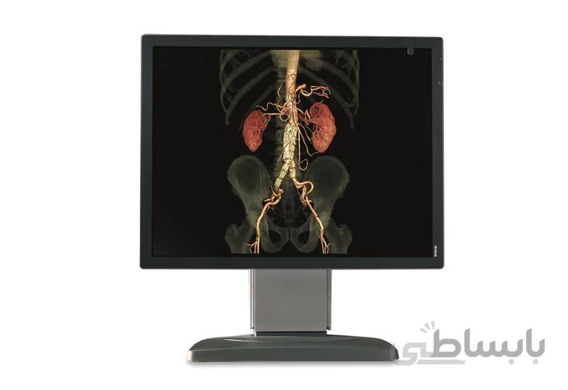 مانیتور پزشکی رنگی 2 مگاپیکسل