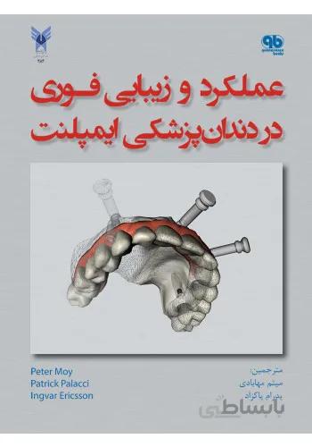 عملکرد و زیبایی فوری در دندانپزشکی ایمپلنت