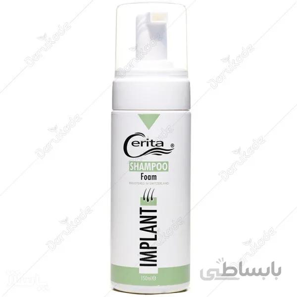 شامپو فوم ایمپلنت سریتا ا Implant Foam Shampoo Cerita