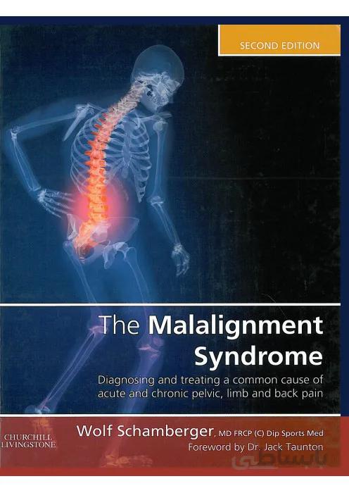 The Malalignment Syndrome Diagnosing and treating a common cause of acute and chronic pelvic, limb and back pain