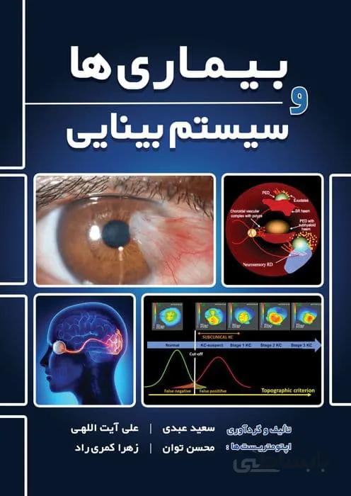 بیماری ها و سیستم بینایی