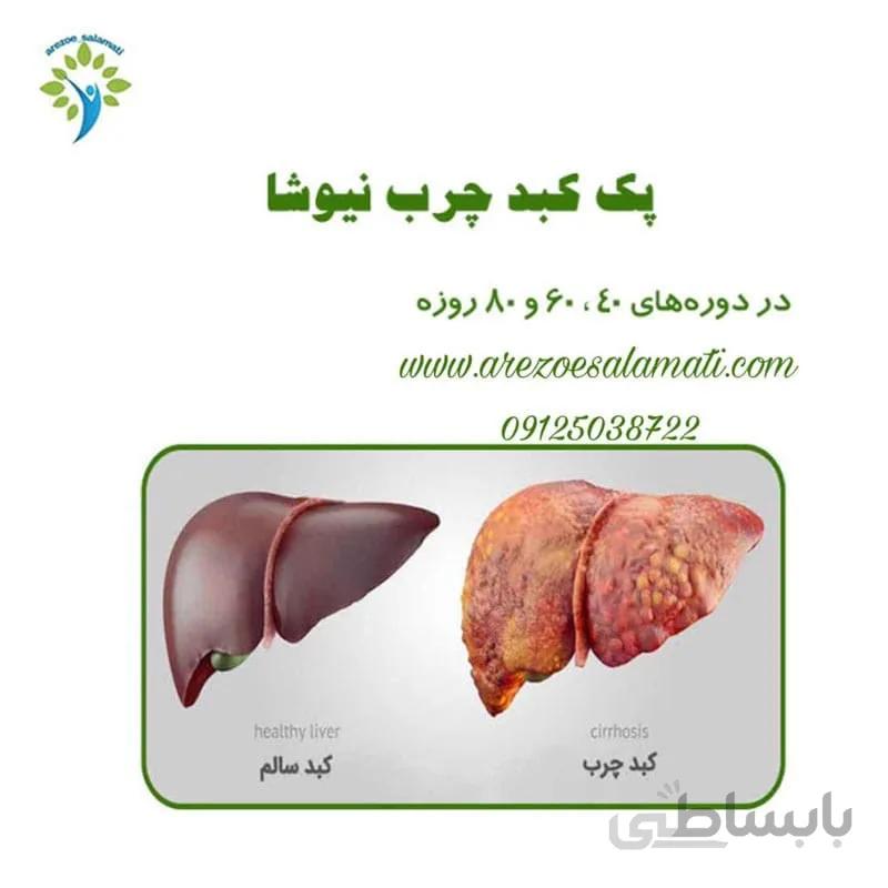 پک اقتصادی کبدچرب نیوشا