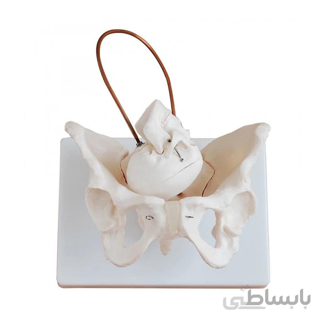 مولاژ لگن با نمایش چرخش سر نوزاد