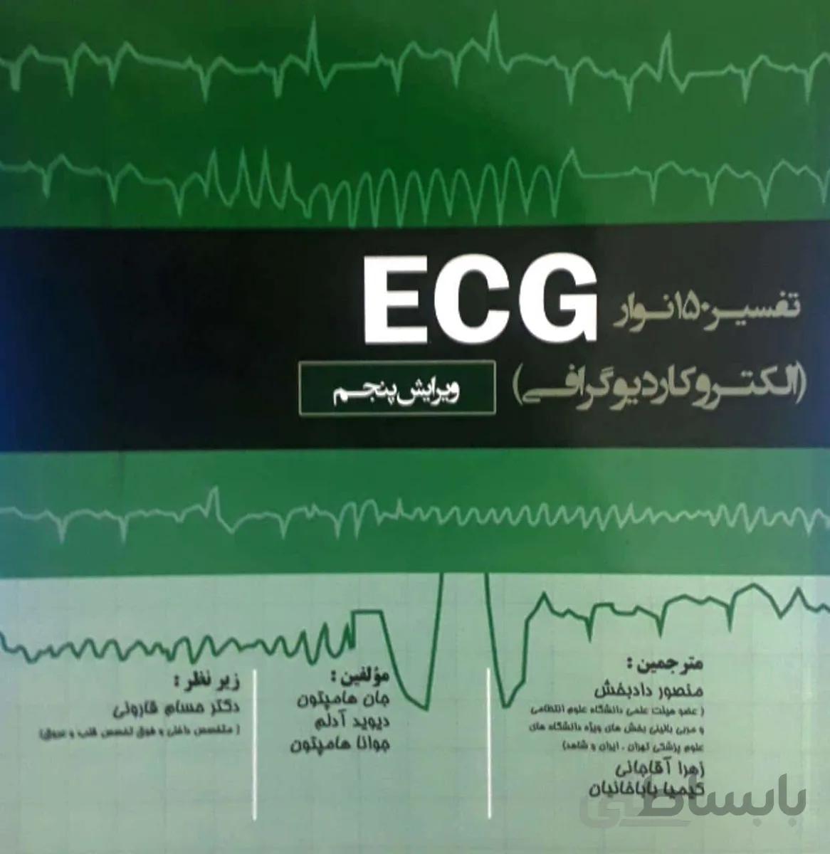 تفسیر ۱۵۰ نوار ECG – الکتروکاردیوگرافی ۲۰۱۹