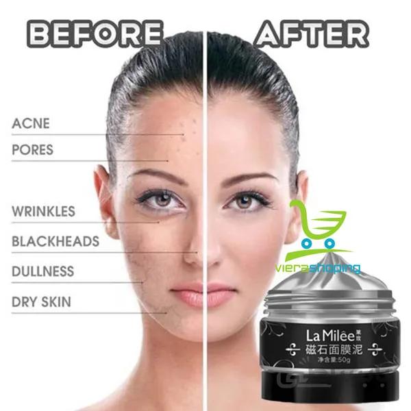 ماسک مغناطیسی جوان سازی صورت lamilee ساخت کره
