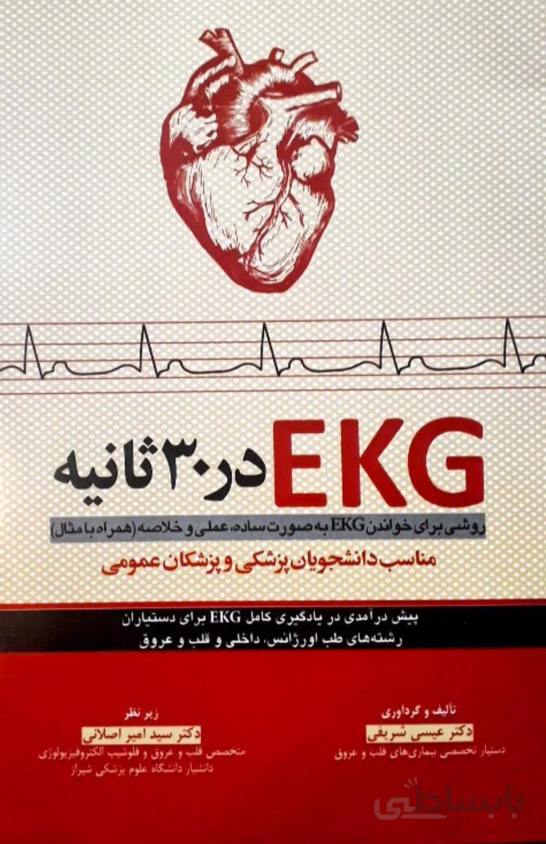 EKG در ۳۰ ثانیه