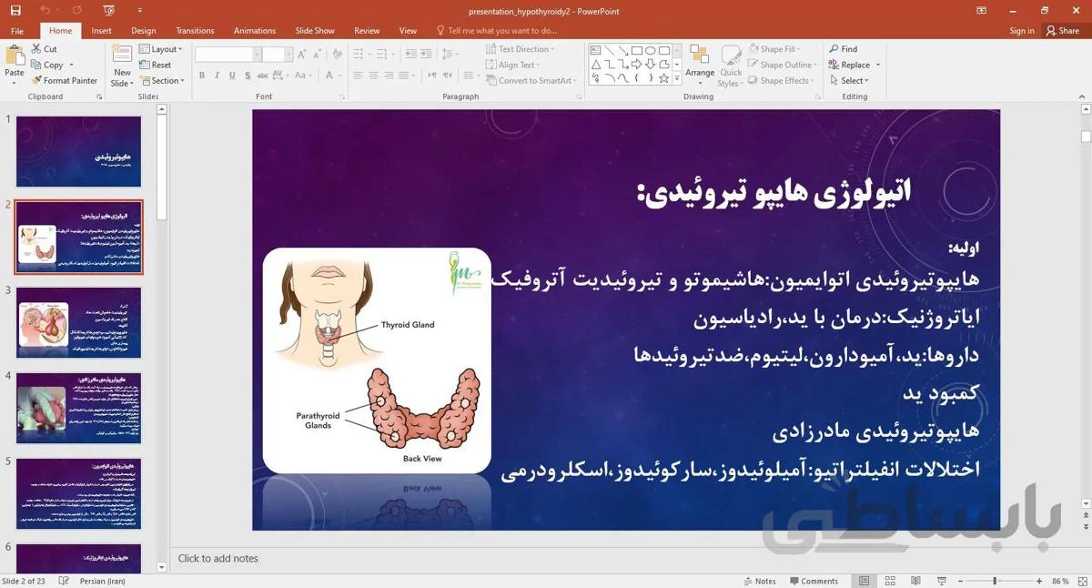 پاورپوینت هایپوتیروئیدی هاریسون - صدتو