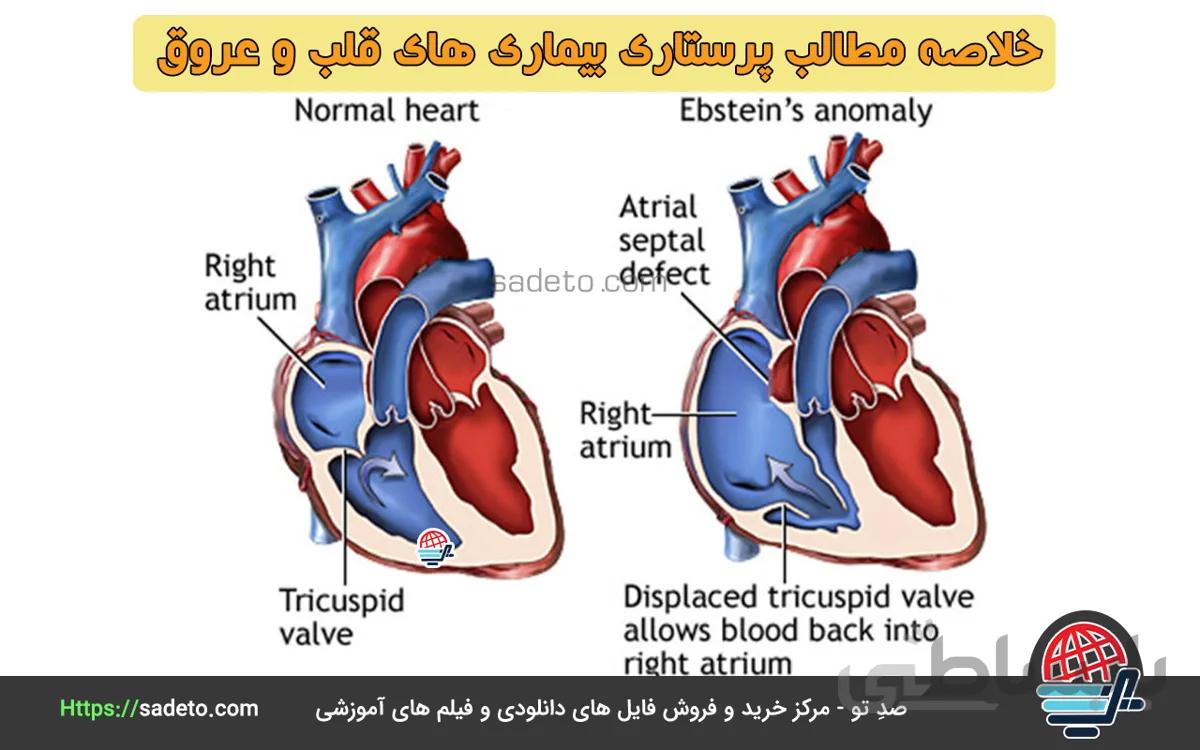 خلاصه مطالب پرستاری بیماری های قلب و عروق - صدتو