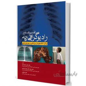 تفسیر تصاویر رادیوگرافی ریه