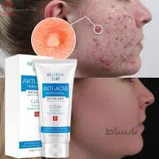 فوم ضد جوش و آکنه بئوتوا ا Anti acne