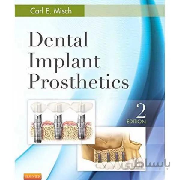 Dental Implant Prosthetics