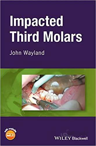 دانلود کتاب Impacted Third Molars - Orginal Pdf