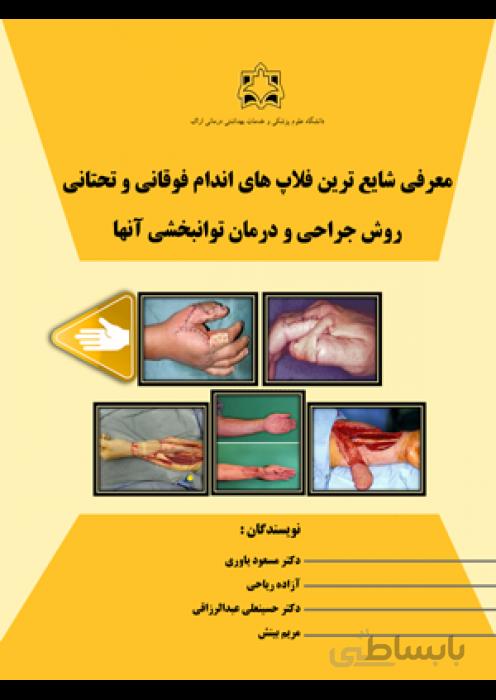معرفی شایع ترین فلاپ های اندام فوقانی و تحتانی روش جراحی و درمان توانبخشی آنها