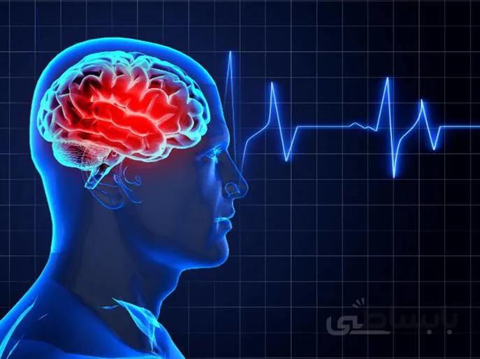 دانلود پوستر مدیریت سکته مغزی حاد (Stroke) بر اساس گایدلاین سال ۲۰۲۰ انجمن قلب آمریکا
