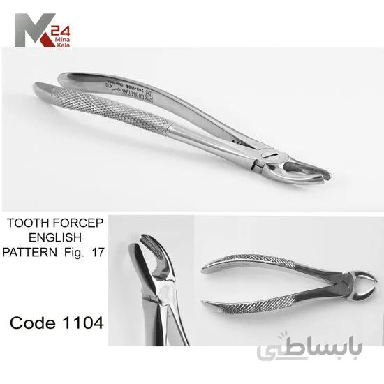 مولر بالا راست -1104