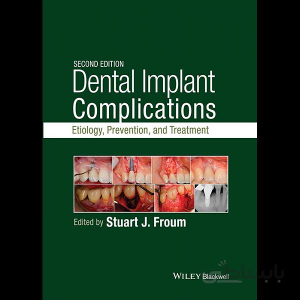 Dental Implant Complications: Etiology, Prevention, and Treatment 2nd Edition
