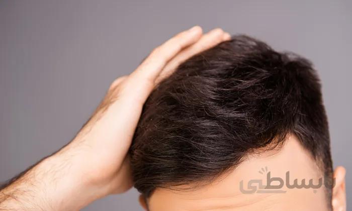 پکیج موی آقایان
