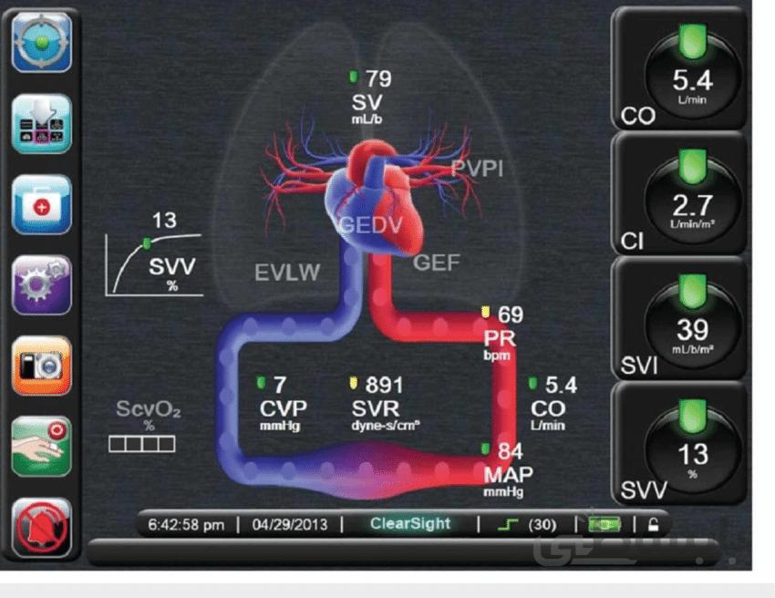وبینار پایش های مهم در بیماران بخش های مراقبت ویژه (Monitoring in ICU Patients)
