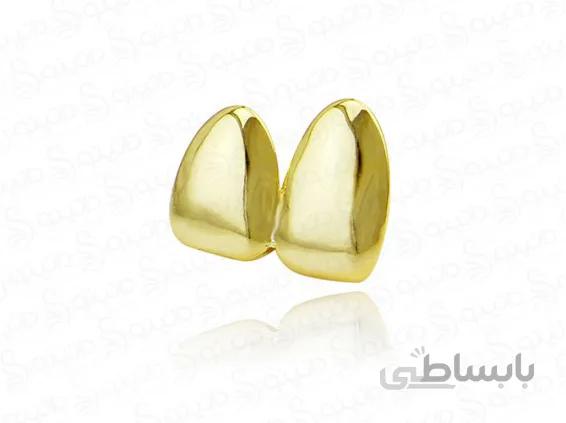 روکش طلای دو دندان hiphop-tooth-2