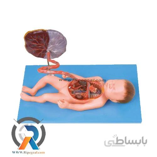 مولاژ جفت و جنین