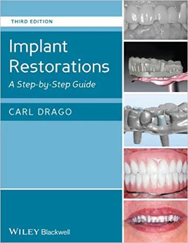 دانلود کتاب Implant Restorations: A Step-by-Step Guide (3rd Edition) - Orginal Pdf