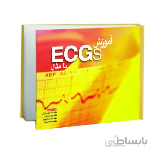 آموزش ECG با مثال