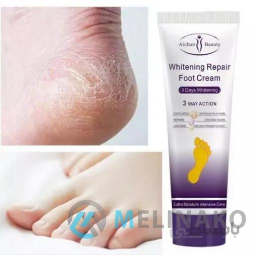 کرم ترمیم کننده ترک پا آیچون بیوتی AICHUN BEAUTY