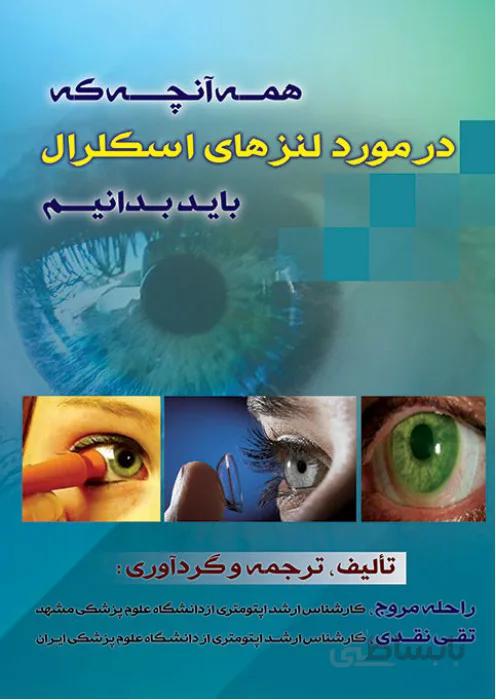 همه آنچه که در مورد لنزهای اسکلرال باید بدانیم