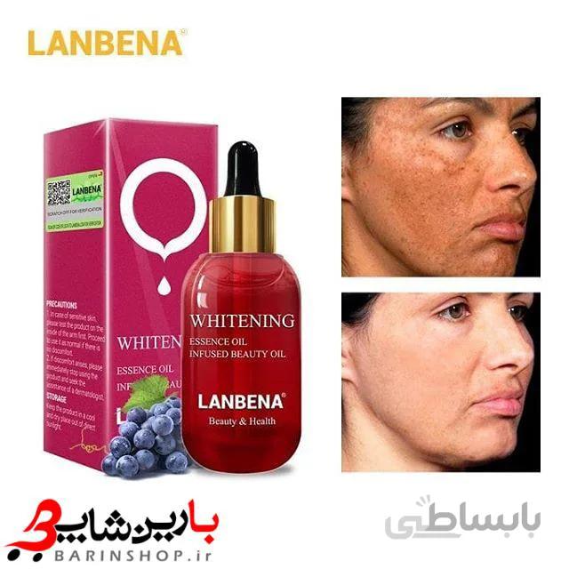 سرم روشن کننده و ضد لک هسته انگور لانبنا LANBENA