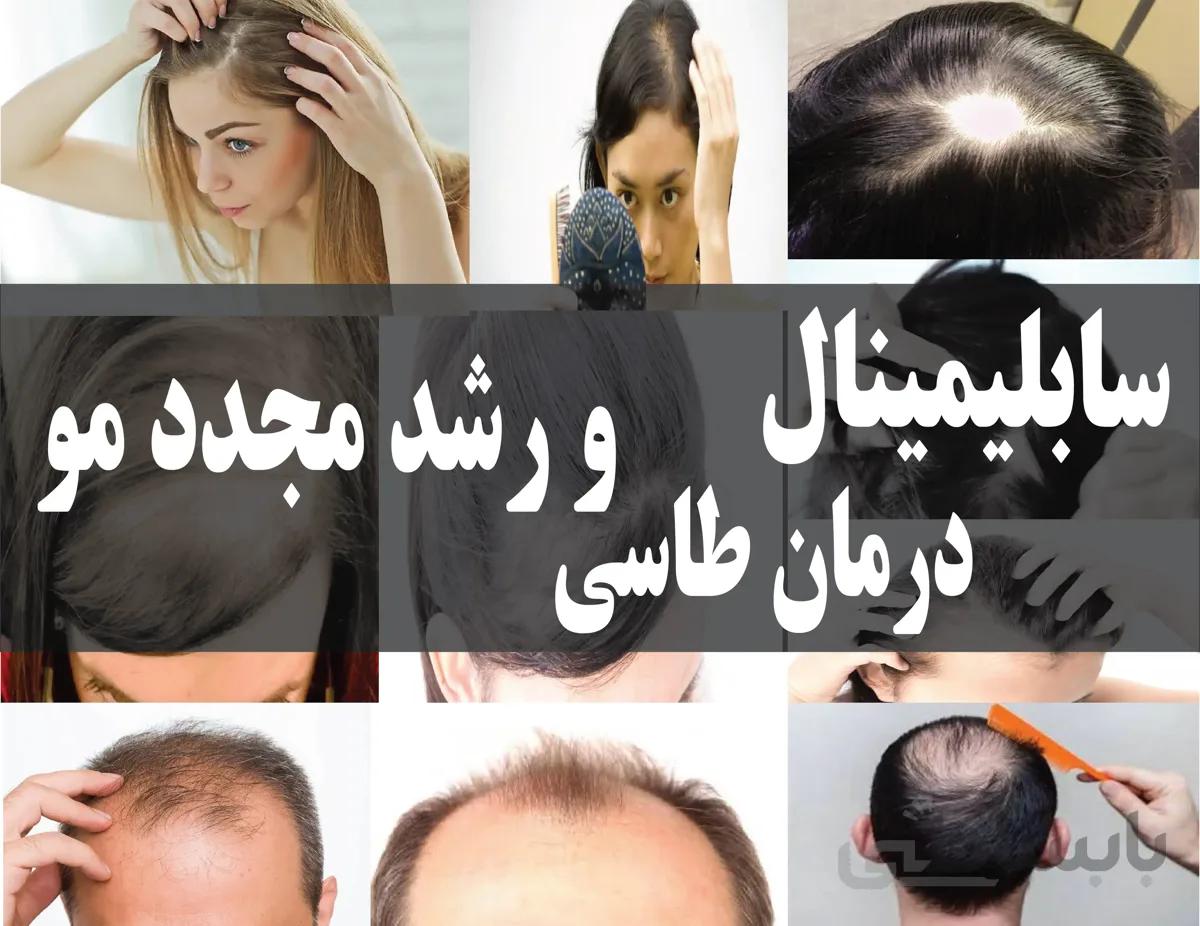 دانلود فایل سابلیمینال درمان طاسی و رشد مجدد مو |