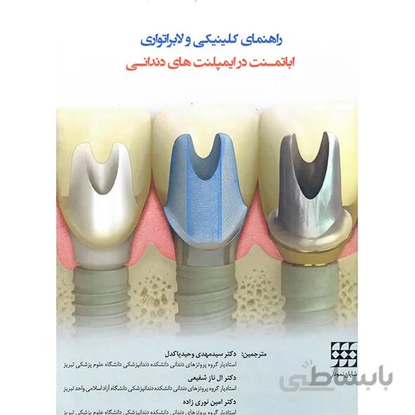 راهنمای کلینیکی و لابراتواری اباتمنت در ایمپلنت های دندانی