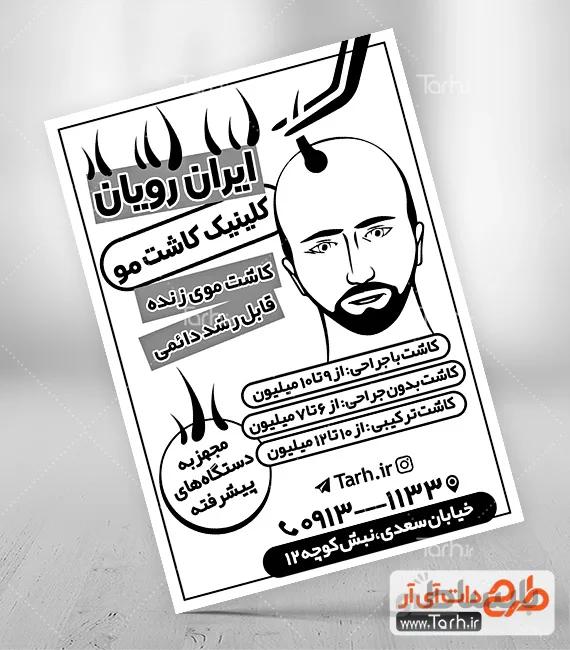 طرح ریسو کاشت مو