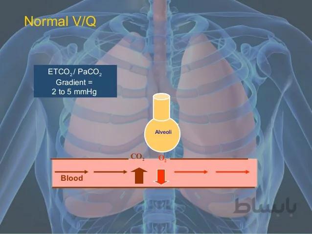 وبینار پایش های تنفسی در بیماران کووید۱۹(Respiratory Monitoring in COVID-19 Patients)