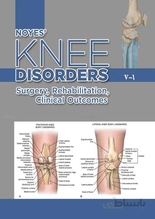 NOYES KNEE DISORDERS,اختلالات زانو