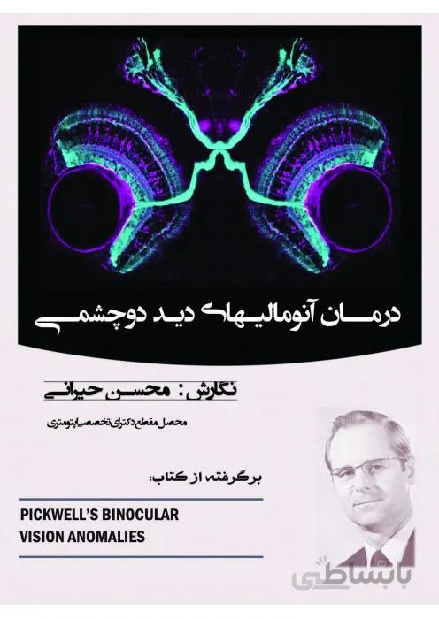 درمان آنومالیهای دید دو چشمی